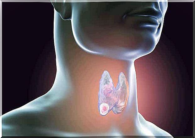 What is a thyroid biopsy