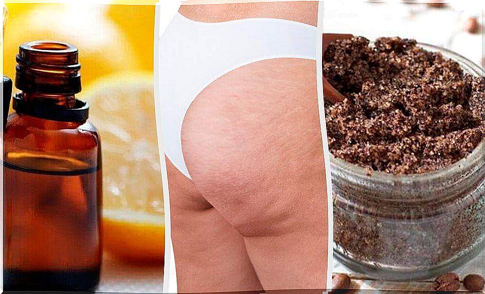 Natural Remedies To Reduce Cellulite