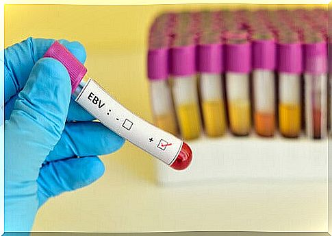 Discovering mononucleosis through a blood test